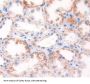 Arylsulfatase F (ARSF) Antibody