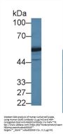 Aspartyl tRNA Synthetase (DARS) Antibody