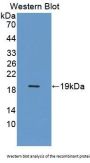 Aspartyl tRNA Synthetase (DARS) Antibody