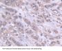 Aspartyl tRNA Synthetase (DARS) Antibody