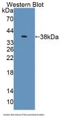 Atrophin 1 (ATN1) Antibody