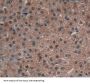 Atrophin 1 (ATN1) Antibody