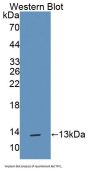 Trefoil Factor 1 (TFF1) Antibody