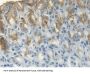 Trefoil Factor 1 (TFF1) Antibody