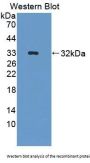 Protein Tyrosine Phosphatase, Non Receptor Type 7 (PTPN7) Antibody