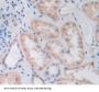 Protein Tyrosine Phosphatase, Non Receptor Type 7 (PTPN7) Antibody