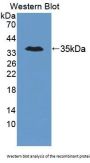 Trinucleotide Repeat Containing Protein 6A (TNRC6A) Antibody