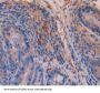 Trinucleotide Repeat Containing Protein 6A (TNRC6A) Antibody