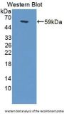 Calpain 6 (CAPN6) Antibody
