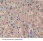 B-Cell CLL/Lymphoma 10 (Bcl10) Antibody