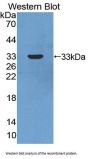 Carbonic Anhydrase XIII (CA13) Antibody