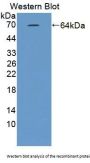 Dynein Heavy Chain Domain Containing Protein 1 (DNHD1) Antibody