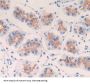 Cyclin B (CCNB) Antibody