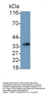 Interleukin 2 Receptor Alpha (IL2RA) Antibody
