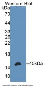 B- And T-Lymphocyte Attenuator (BTLA) Antibody