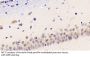 Toll Like Receptor 3 (TLR3) Antibody