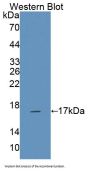 Natural Cytotoxicity Triggering Receptor 3 (NCR3) Antibody