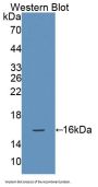 Natural Cytotoxicity Triggering Receptor 3 (NCR3) Antibody