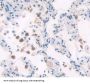 Polymerase DNA Directed Delta 1 (POLd) Antibody