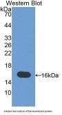 Melanoma-Derived Growth Regulatory Protein (MIA) Antibody