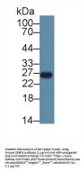 CCAAT/Enhancer Binding Protein Delta (CEBPd) Antibody