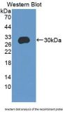 CCAAT/Enhancer Binding Protein Delta (CEBPd) Antibody