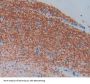 Engulfment And Cell Motility 2 (ELMO2) Antibody