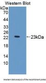 Kinectin 1 (KTN1) Antibody