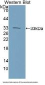 Kinectin 1 (KTN1) Antibody