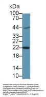 Chorionic Gonadotropin Beta Polypeptide 1 (CGb1) Antibody