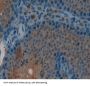 Chorionic Gonadotropin Beta Polypeptide 1 (CGb1) Antibody