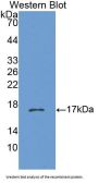 Cholinergic Receptor, Nicotinic, Beta 3 (CHRNb3) Antibody