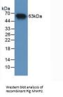 Matrix Metalloproteinase 2 (MMP2) Antibody