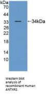Anthrax Toxin Receptor 2 (ANTXR2) Antibody
