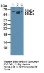 Anthrax Toxin Receptor 2 (ANTXR2) Antibody