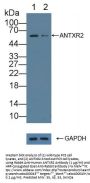 Anthrax Toxin Receptor 2 (ANTXR2) Antibody