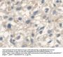 Anthrax Toxin Receptor 2 (ANTXR2) Antibody