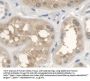 Anthrax Toxin Receptor 2 (ANTXR2) Antibody