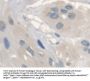 Anthrax Toxin Receptor 2 (ANTXR2) Antibody