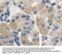 Anthrax Toxin Receptor 2 (ANTXR2) Antibody