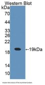 Cellular Retinoic Acid Binding Protein 1 (CRABP1) Antibody