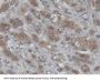 Cellular Retinoic Acid Binding Protein 1 (CRABP1) Antibody