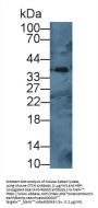Cathepsin H (CTSH) Antibody