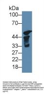 17-Alpha-Hydroxylase (S17aH) Antibody