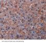 17-Alpha-Hydroxylase (S17aH) Antibody