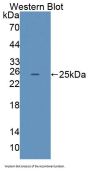 Low Density Lipoprotein Receptor Related Protein 2 (LRP2) Antibody