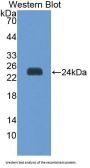 Spermidine/Spermine N1-Acetyltransferase 1 (SAT1) Antibody