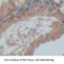 Spermidine/Spermine N1-Acetyltransferase 1 (SAT1) Antibody