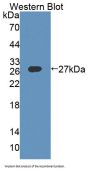 Dystrophia Myotonica Protein Kinase (DMPK) Antibody