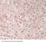 Dystrophia Myotonica Protein Kinase (DMPK) Antibody